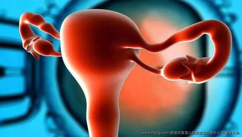 美国代孕的具体流程是什么 方案有几种