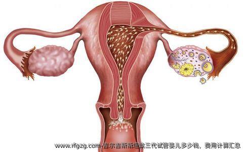吉尔吉斯斯坦做三代代孕多少钱,费用计算汇总