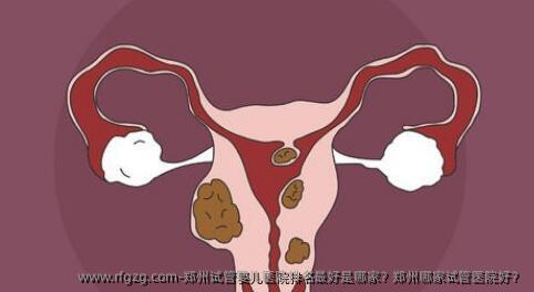 郑州代孕医院排名较好是哪家?郑州哪家试管医院好?