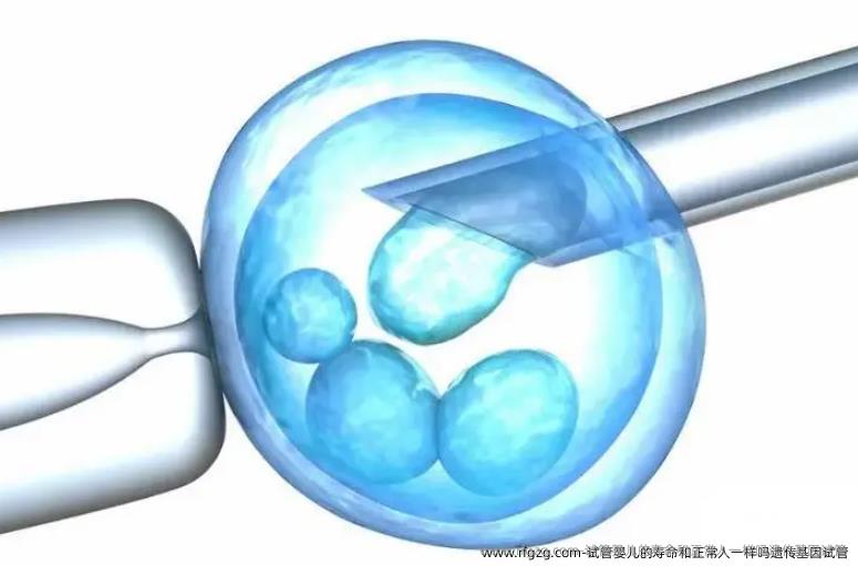 代孕的寿命和正常人一样吗遗传基因试管