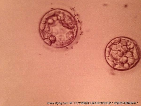 荆门三大试管婴儿医院成功率排名？试管助孕费用参考？