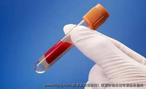 简单姿势告诉你!试管移植后这样更容易着床
